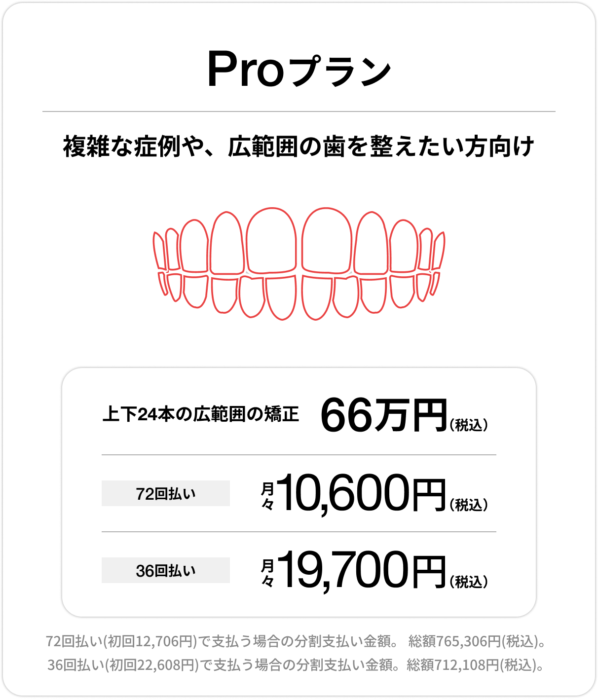 Proプラン、上下前歯24本の部分矯正66万円（税込）、72回払い 月々10,600円（税込）、36回払い 月々19,700円（税込）