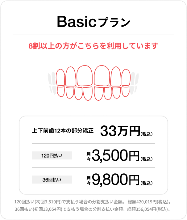 Basicプラン、上下前歯12本の部分矯正33万円（税込）、120回払い 月々3,500円（税込）、36回払い 月々9,800円（税込）