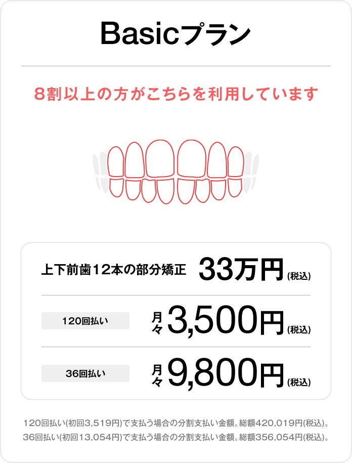 Basicプラン、上下前歯12本の部分矯正33万円（税込）、120回払い 月々3,500円（税込）、36回払い 月々9,800円（税込）
