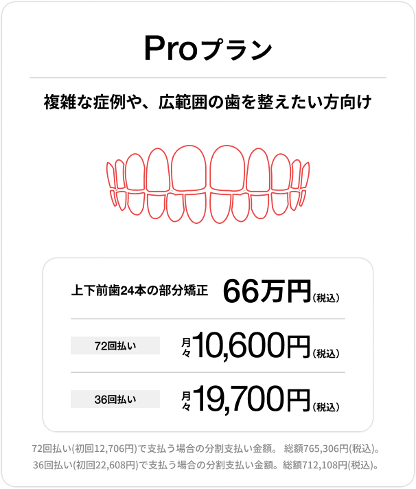 Proプラン、上下前歯24本の部分矯正66万円（税込）、72回払い 月々10,600円（税込）、36回払い 月々19,700円（税込）