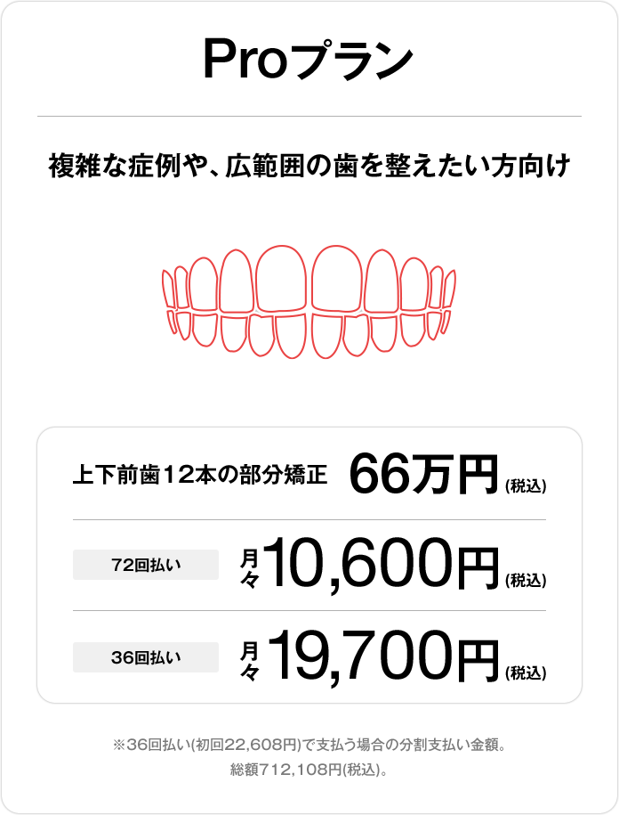 Proプラン、上下前歯24本の部分矯正66万円（税込）、72回払い 月々10,600円（税込）、36回払い 月々19,700円（税込）