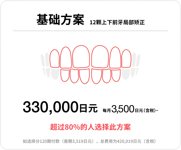 Basicプラン、上下前歯12本の部分矯正、33万円、月々(税込)3,500円〜