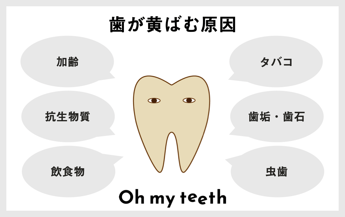 ホワイトニングの仕組みを知って本当に満足できる方法を選ぼう