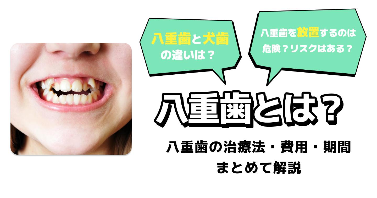 八重歯とは？放置するリスクや治療方法・費用・期間を解説