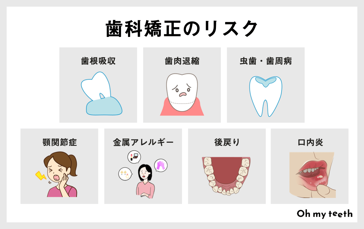 歯科矯正のリスク