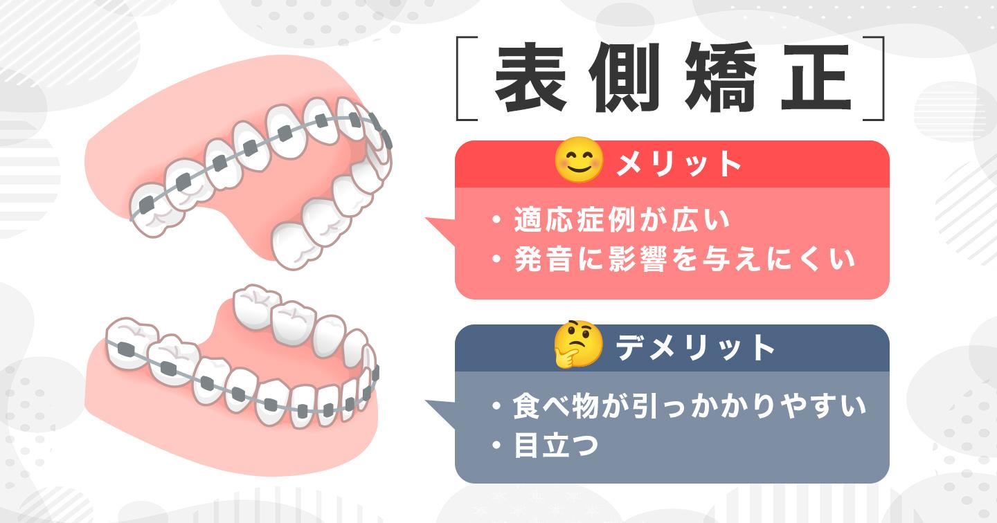 表側矯正のメリットとデメリット