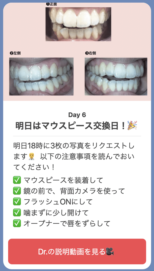 通わないマウスピース矯正 Oh my teethのメリット・デメリットを公式ブログ担当が徹底解説