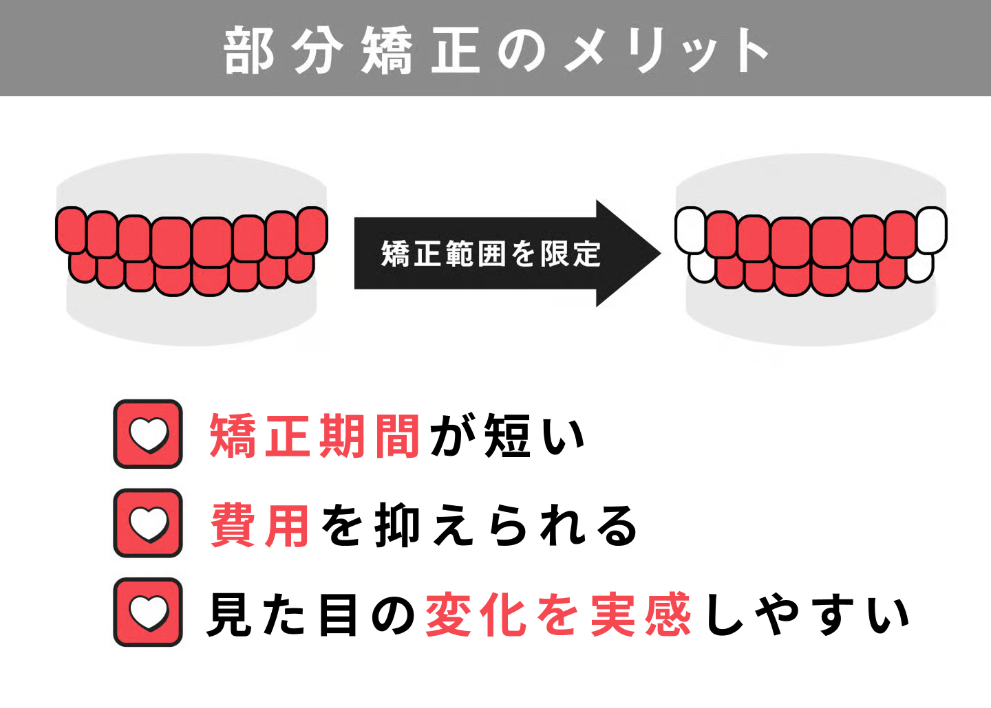部分矯正のメリット