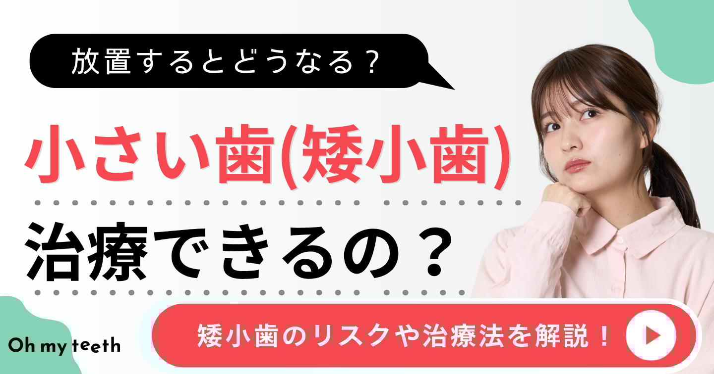 歯が小さい　アイキャッチ
