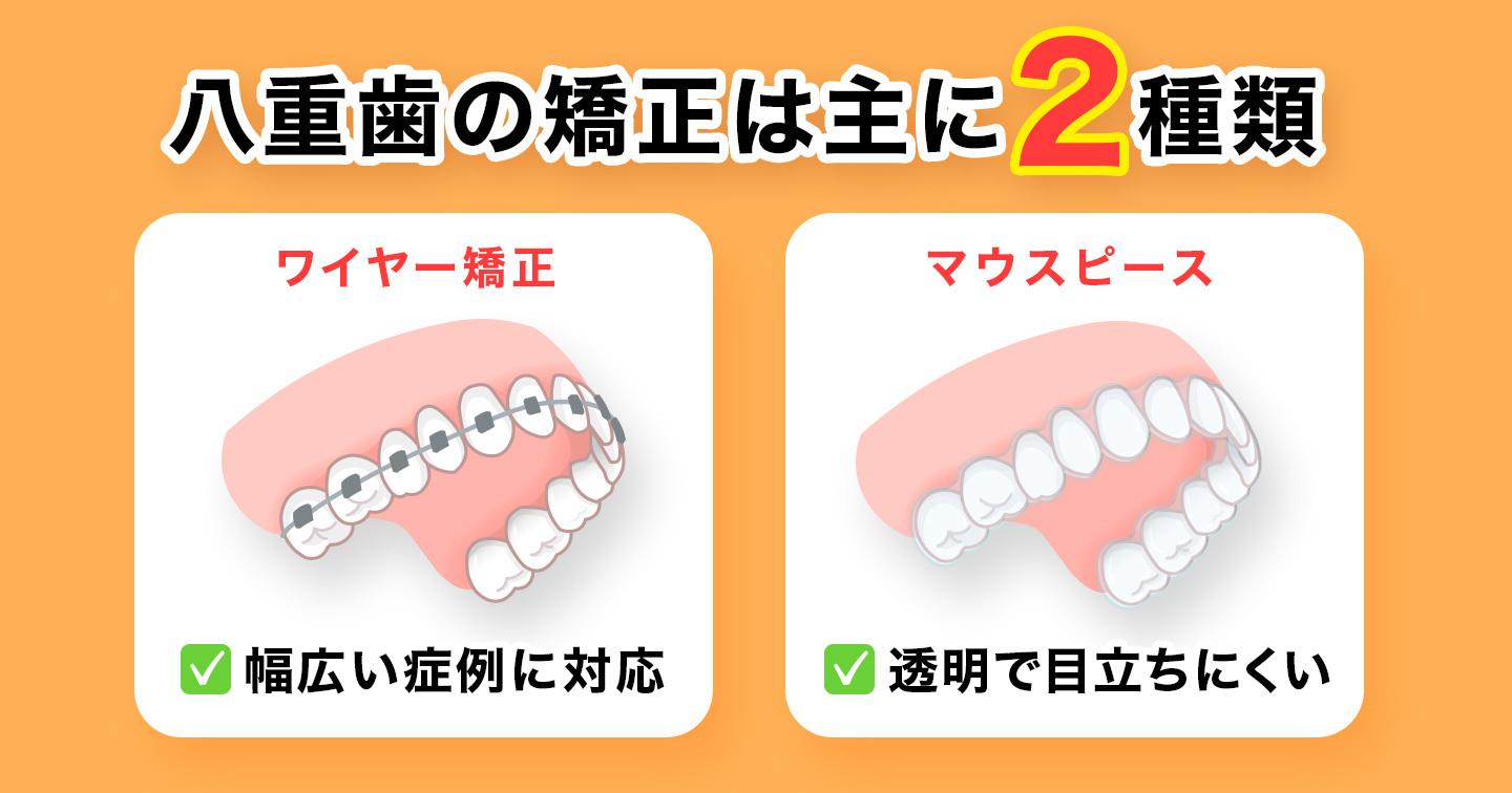 八重歯治療2種類