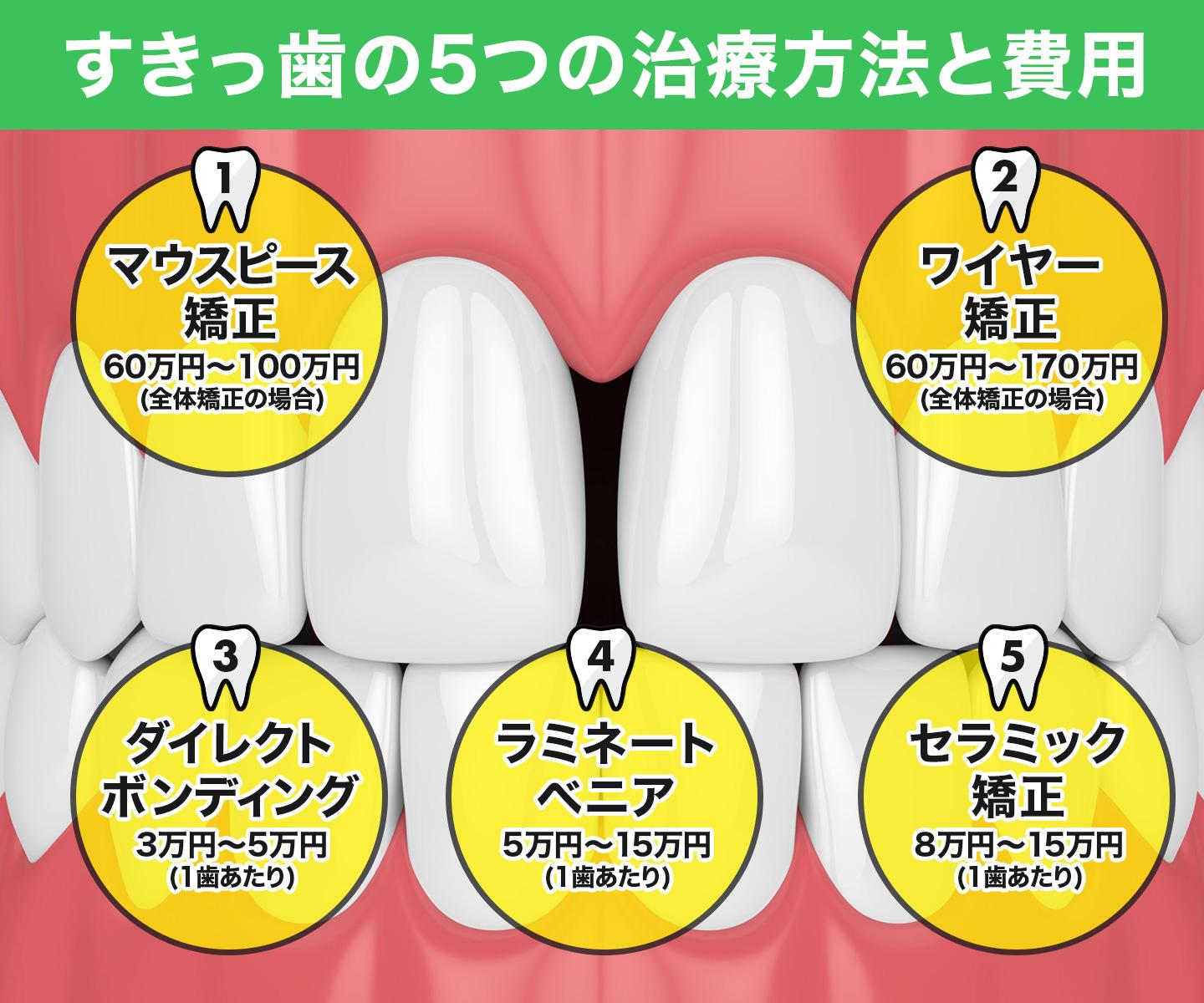 すきっ歯の5つの治療方法
