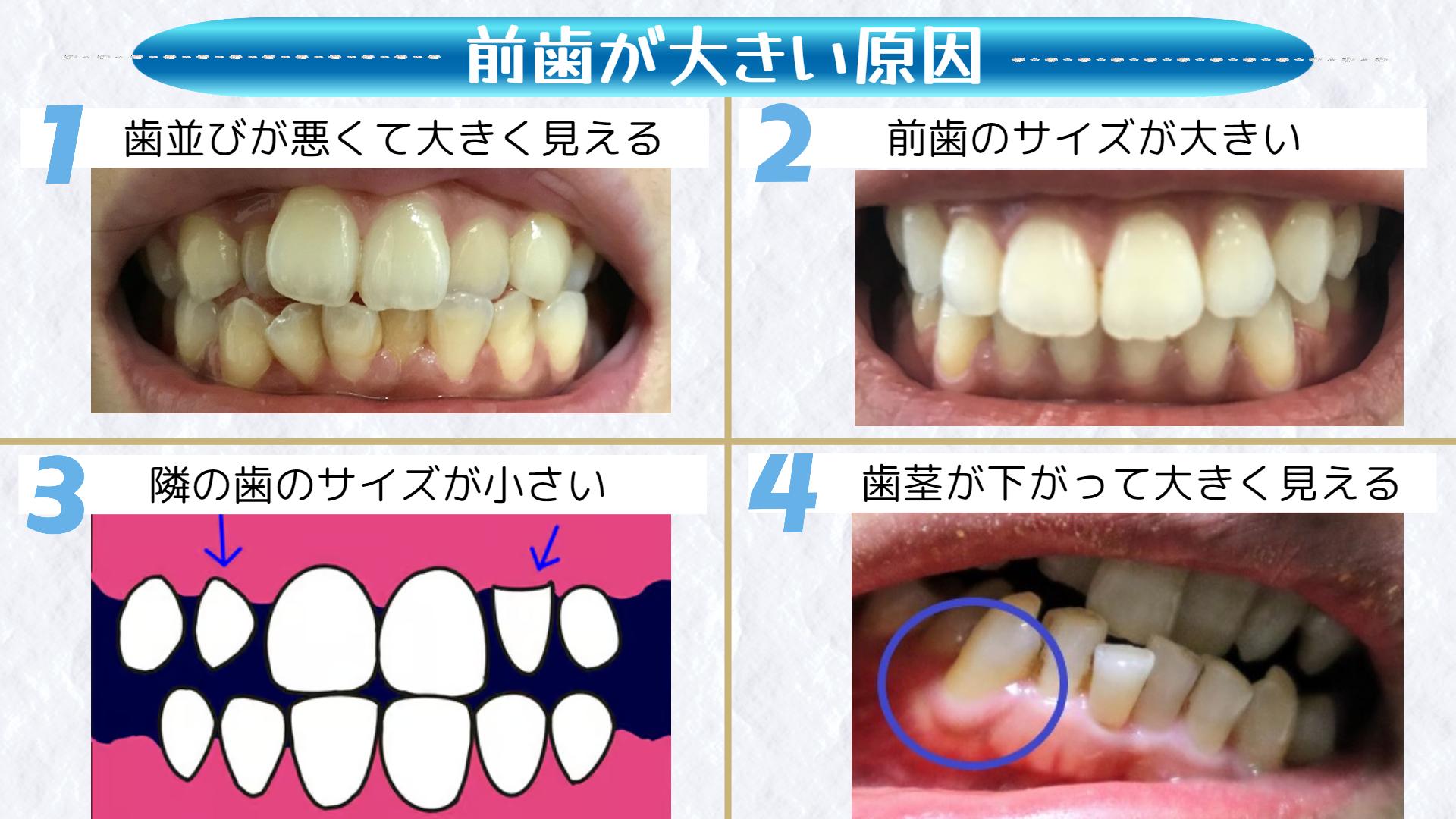 画像素材①