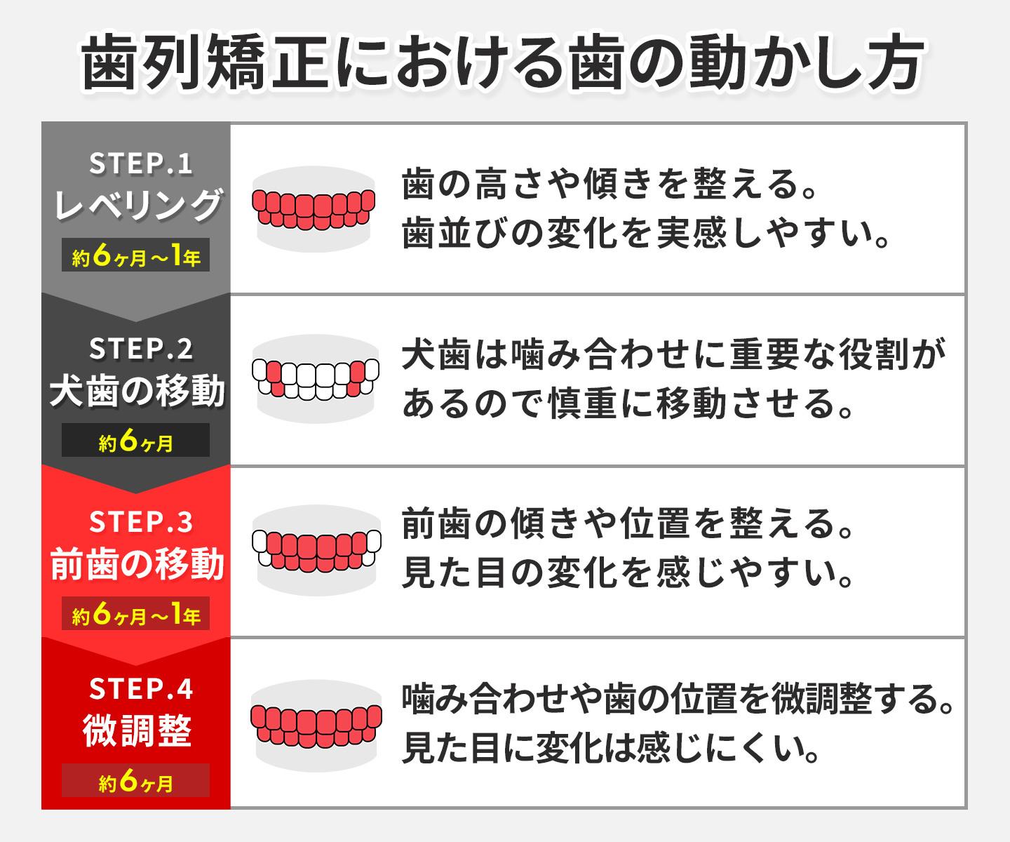 歯列矯正における歯の動かし方