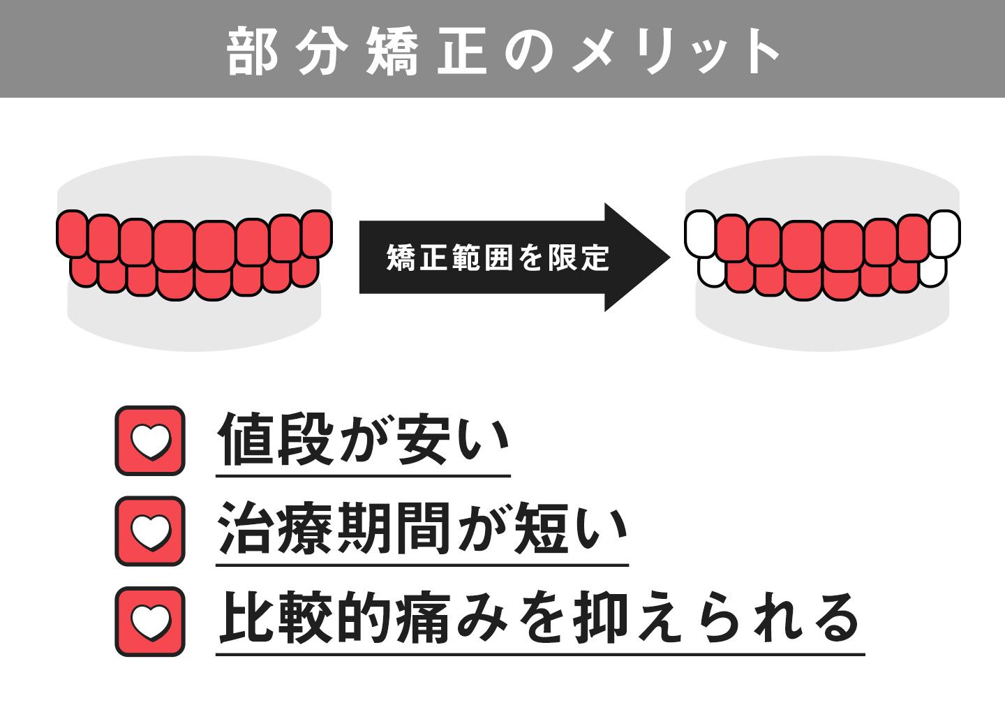 部分矯正のメリット