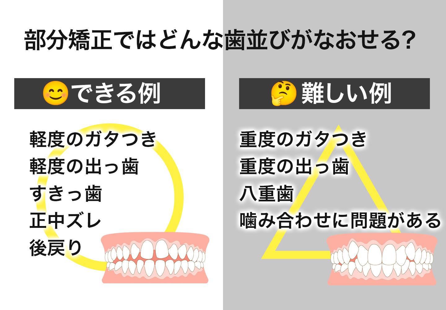 部分矯正でなおせる歯並び・なおせない歯並びの例