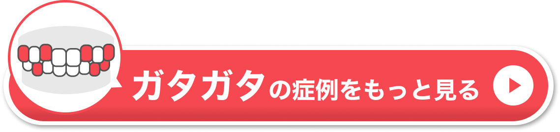 ガタガタの症例をもっと見る