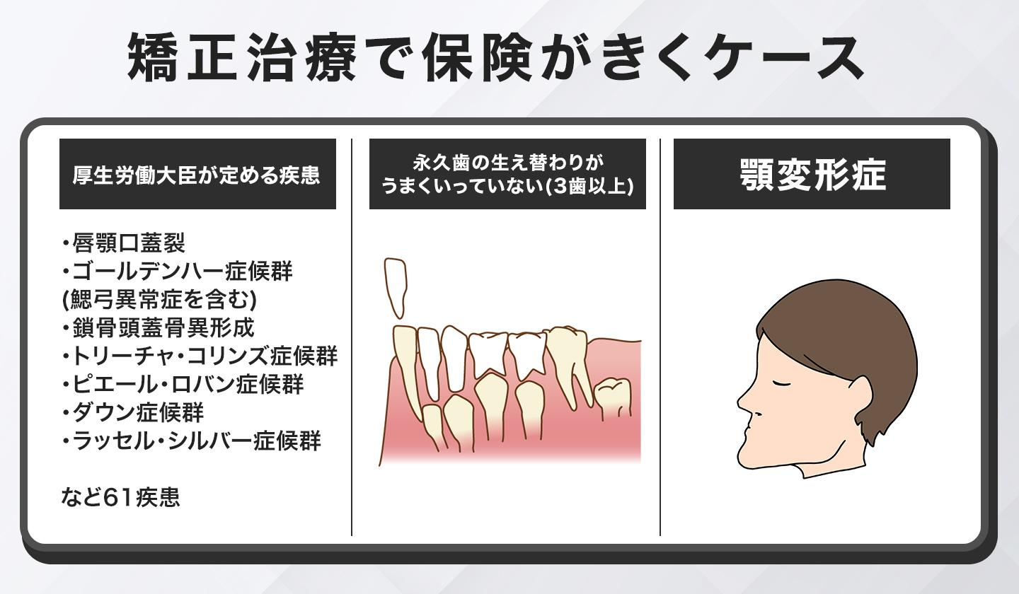 矯正治療で保険適用になるケース