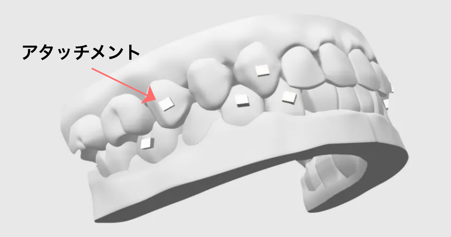 アタッチメント（エンゲージャー）をつけたとき