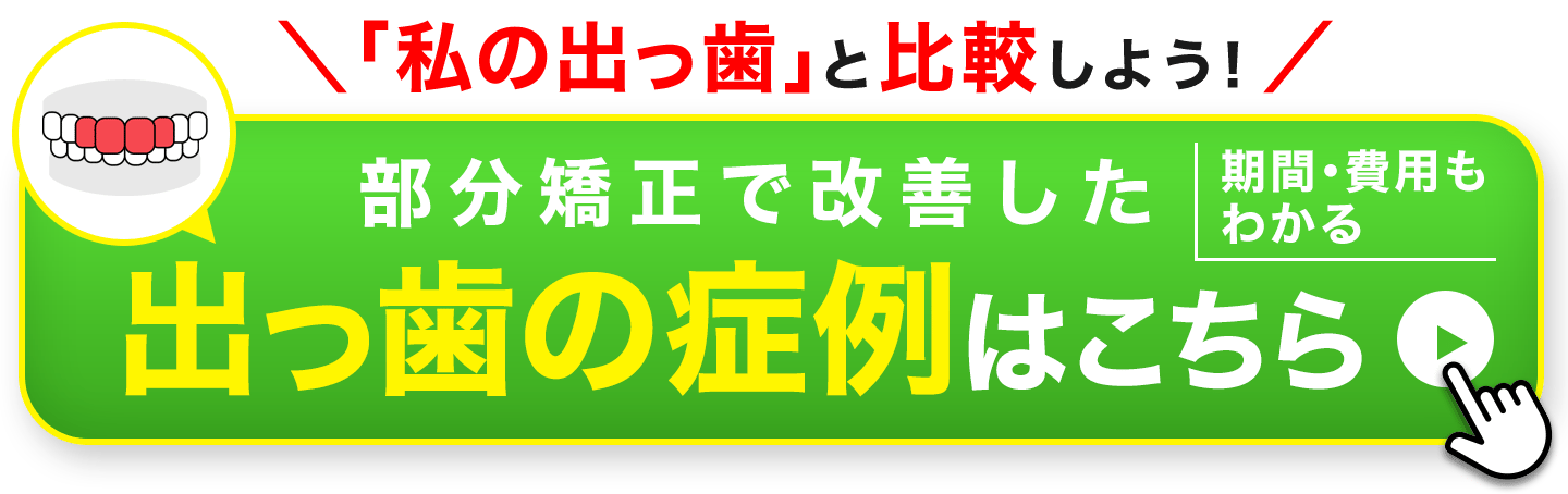 CTA症例_出っ歯