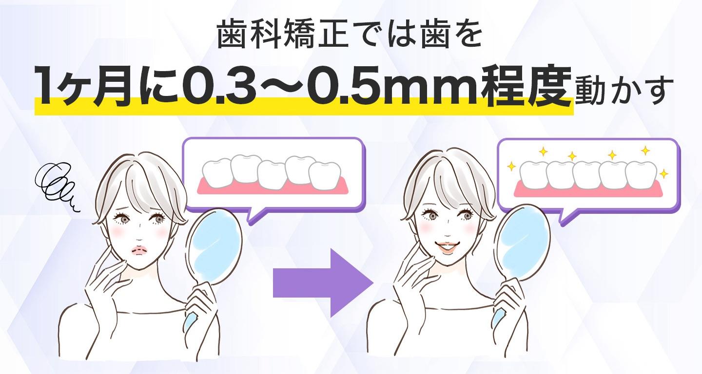 歯列矯正では1ヶ月に0.3〜0.5mm程度歯を動かす