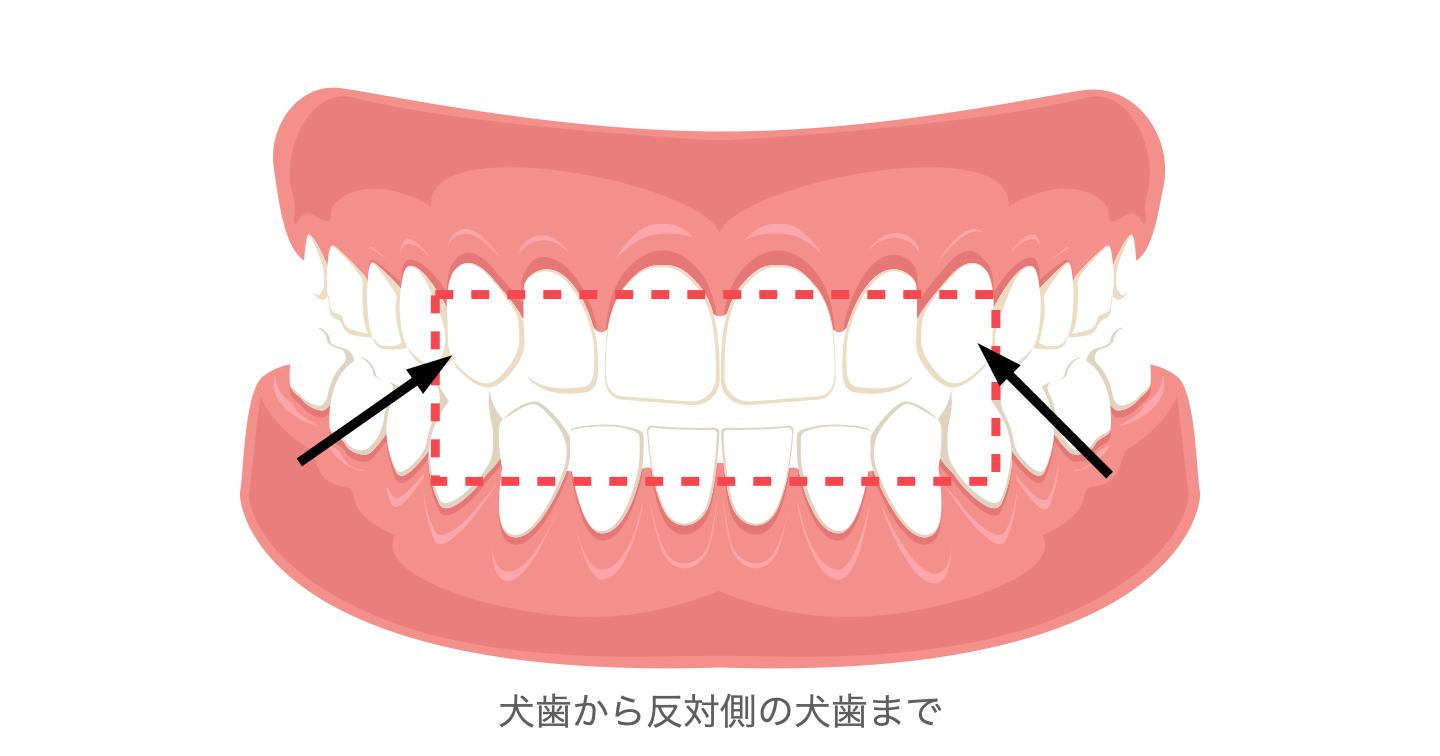 Basic適応範囲