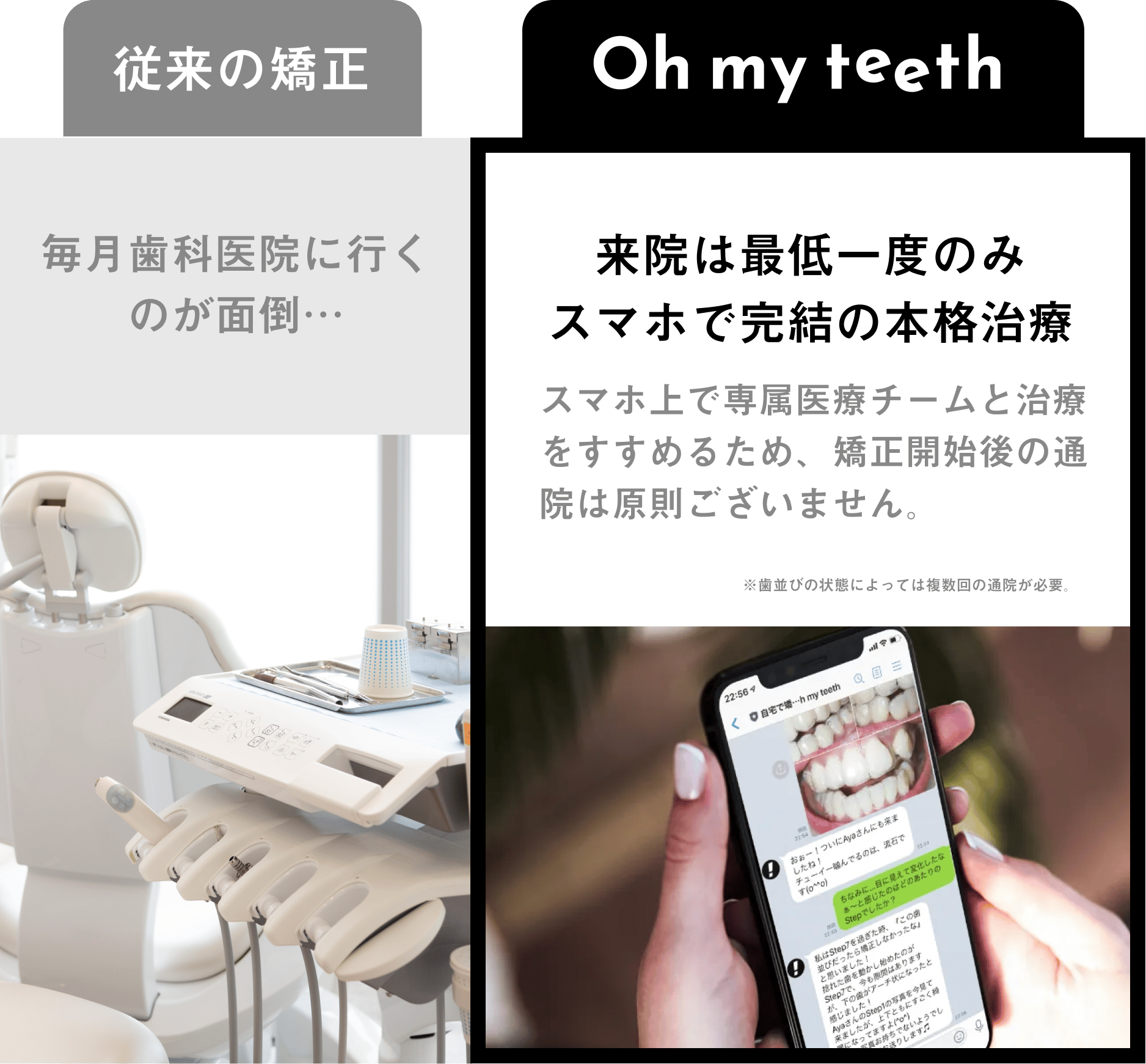 Oh my teethと従来の矯正との違い①通院不要