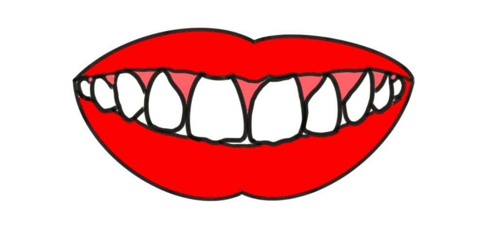【歯学博士が解説】お笑いコンビ “ダイアン” の津田篤宏さん 「歯が多い」と言われるのはなぜ？
