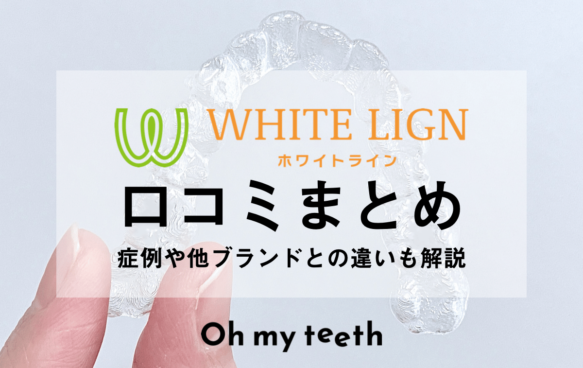 ホワイトライン矯正の口コミ・対応症例・他ブランドとの違いを徹底解説！