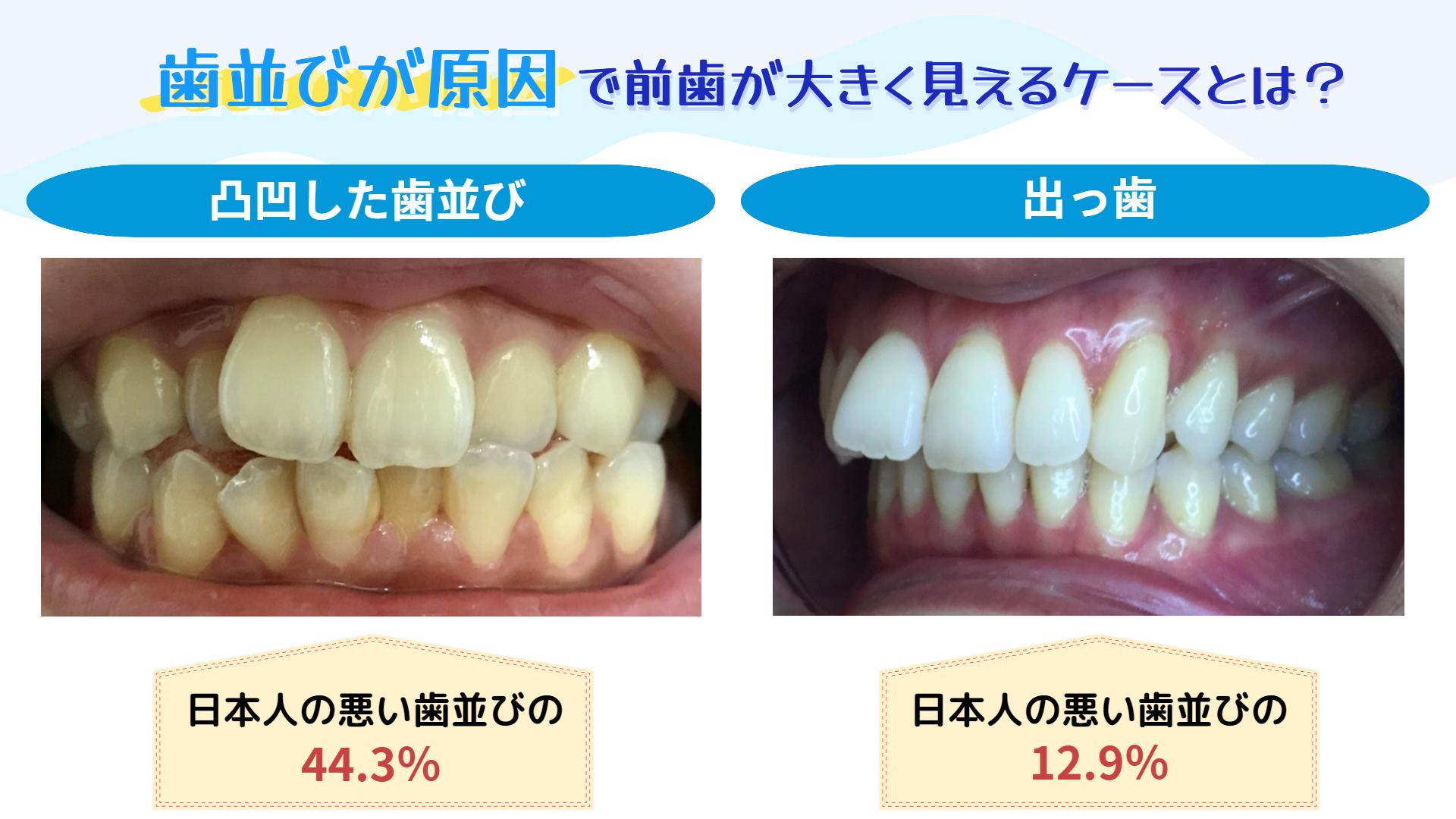 )画像素材③
