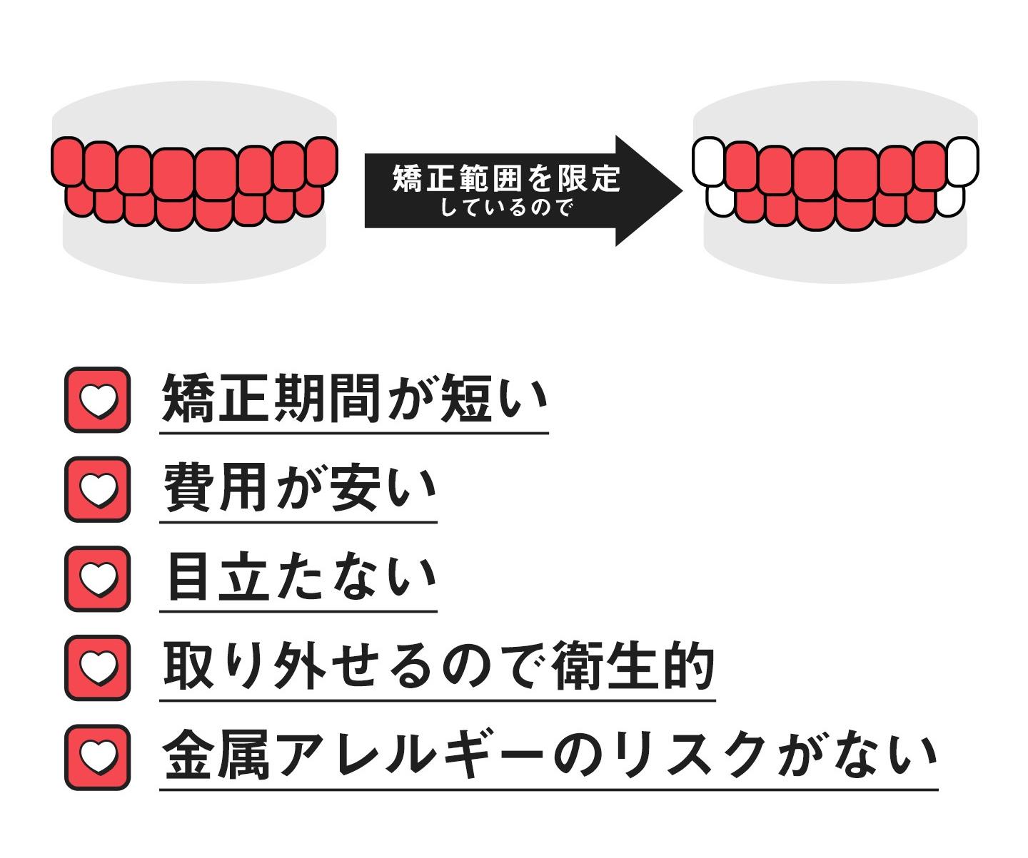 前歯だけのマウスピース矯正のメリット