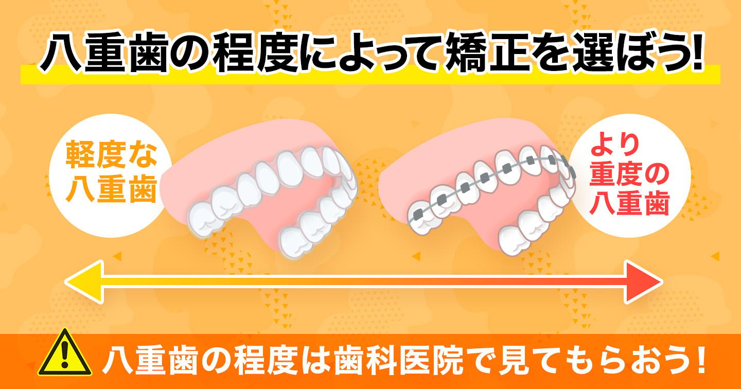 八重歯の程度によって治療方法は異なる