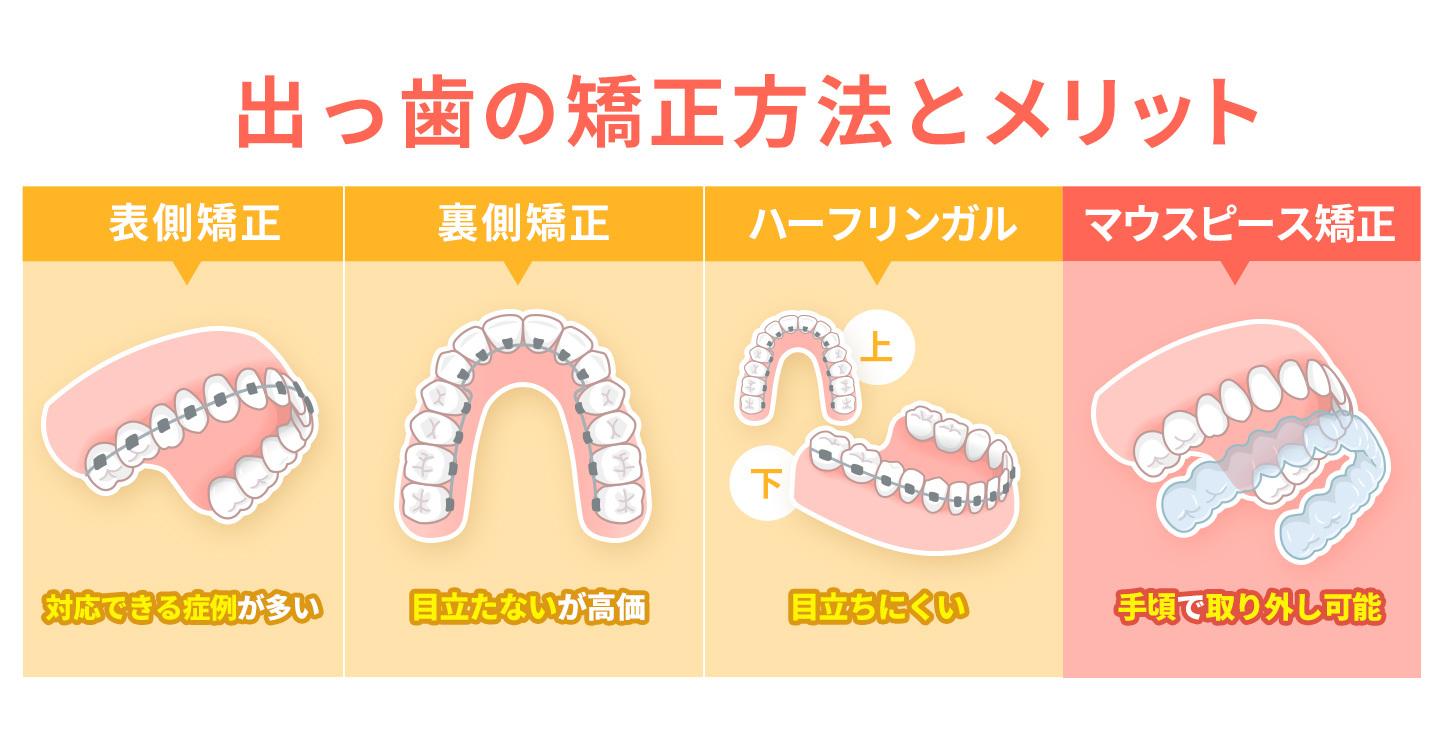 治療方法分類と特徴