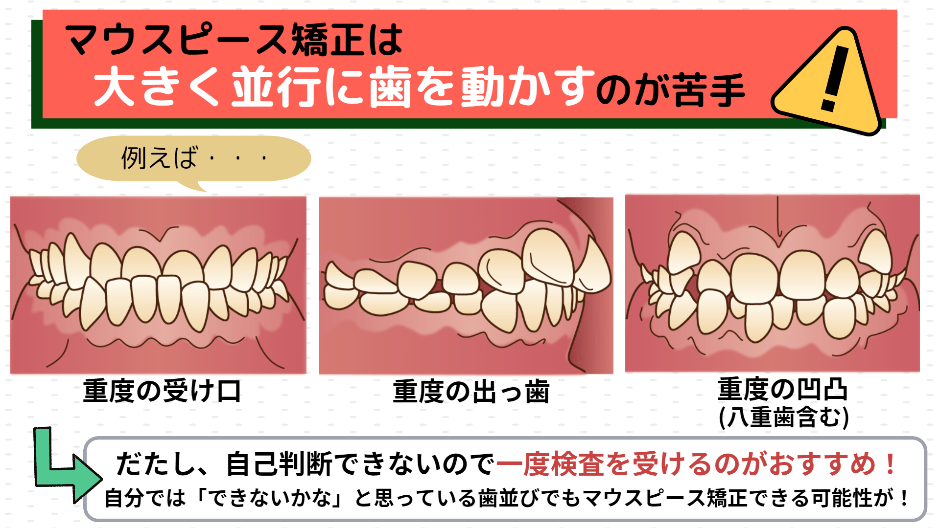 マウスピース矯正は大きく平行に歯を動かすのが苦手