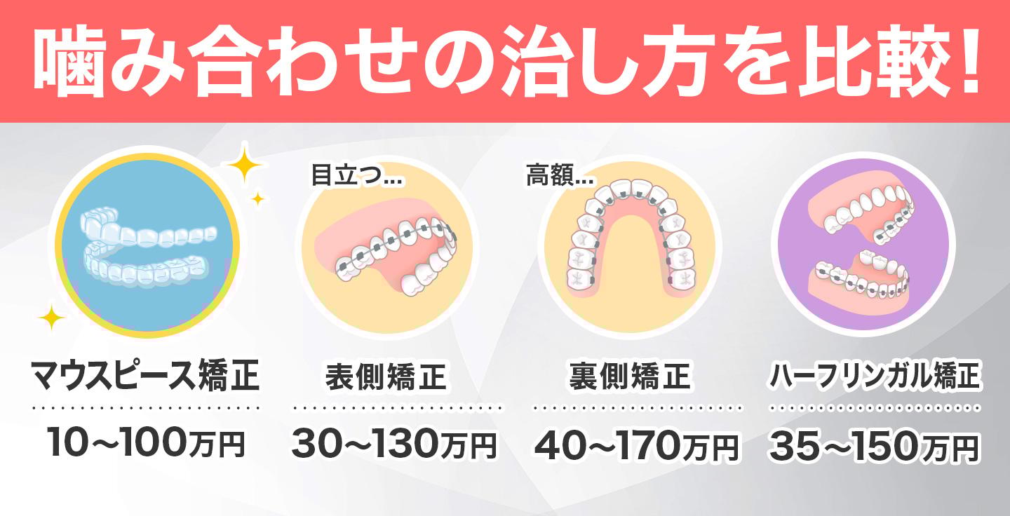 レジェンド記事CR3