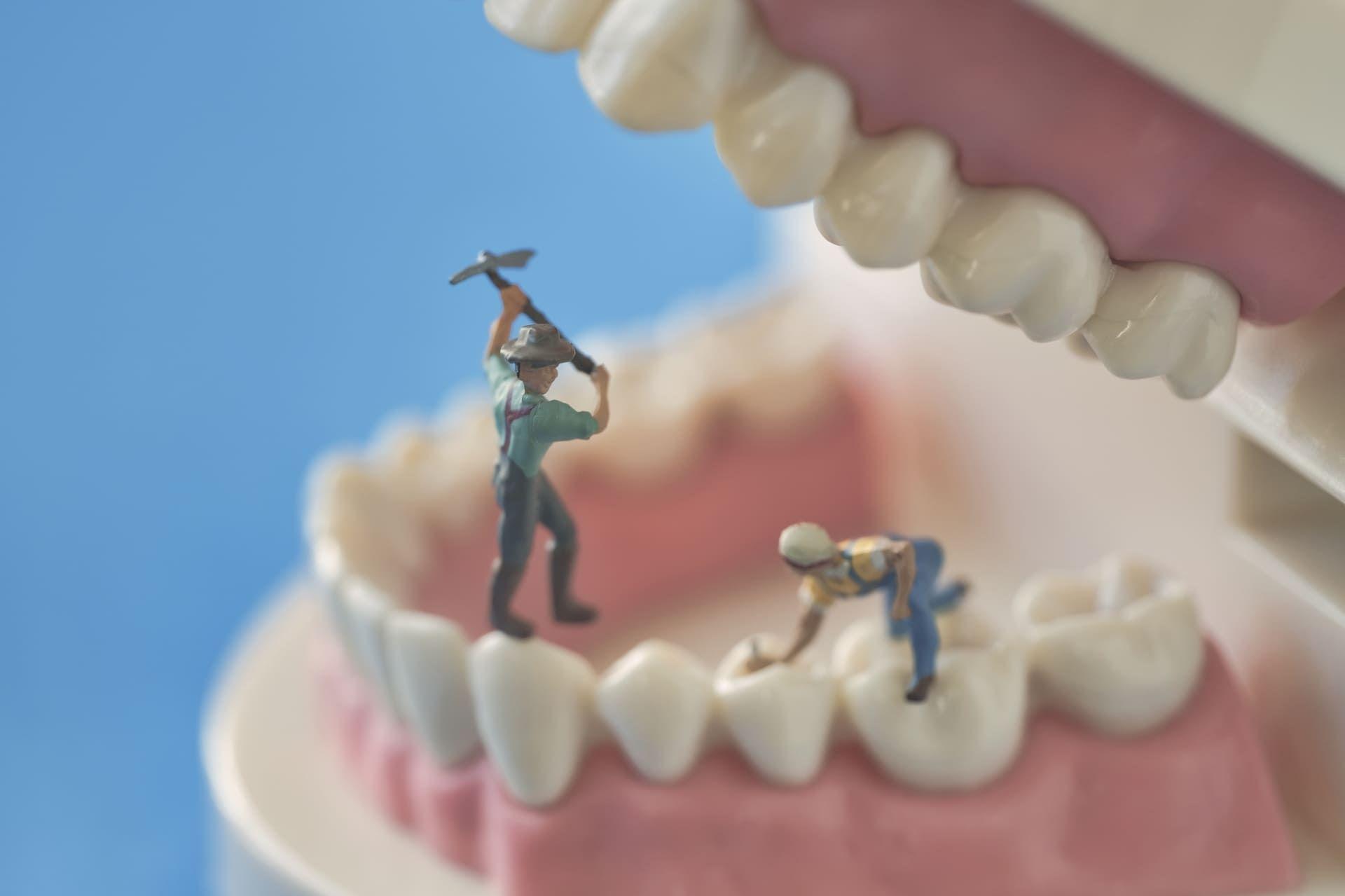 セラミック矯正とは？歯科矯正との違いと起こり得るリスク