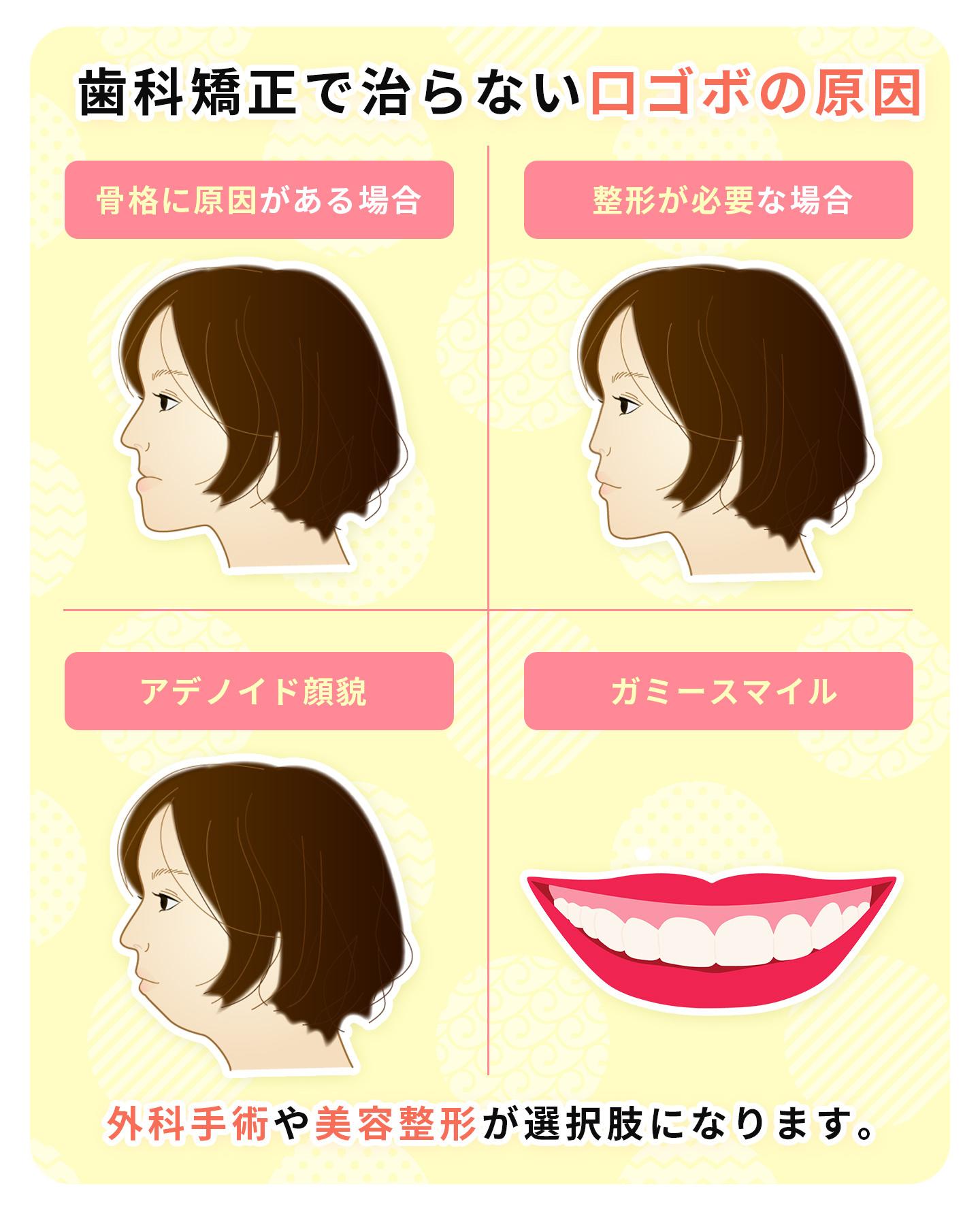 矯正で治らない口ゴボの原因