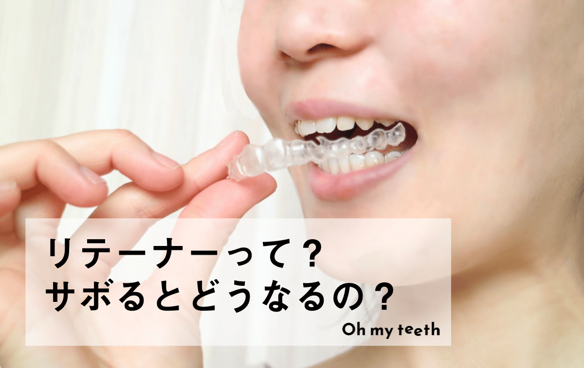 リテーナーは一生つけるもの？