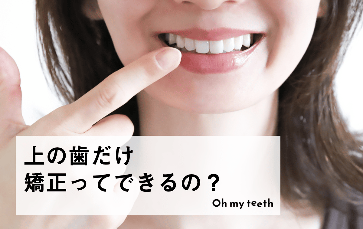 上の歯だけ歯科矯正できる？