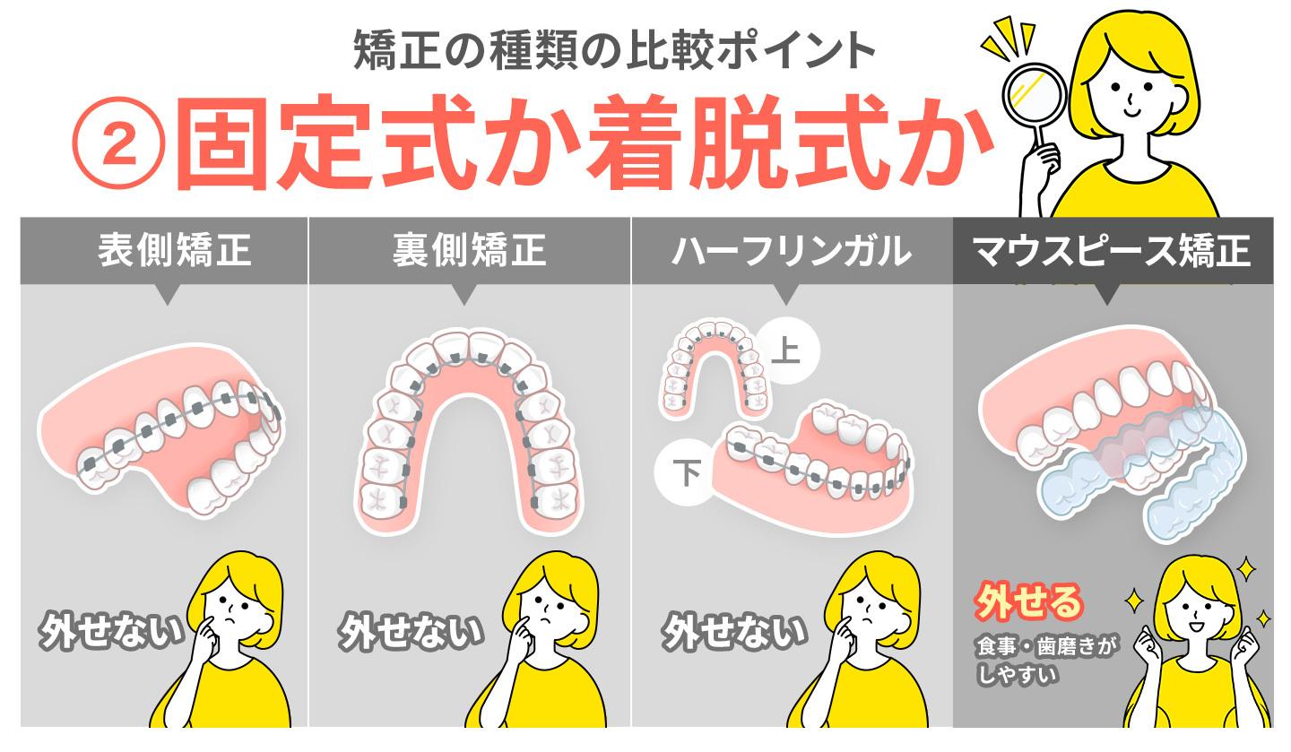 大人の歯科矯正の種類を比較するポイント②固定式か着脱式か