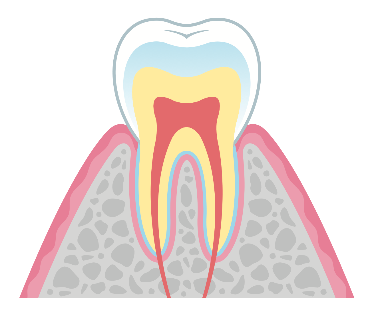 歯の黄ばみの6大原因！ホワイトニング方法や予防法を解説 