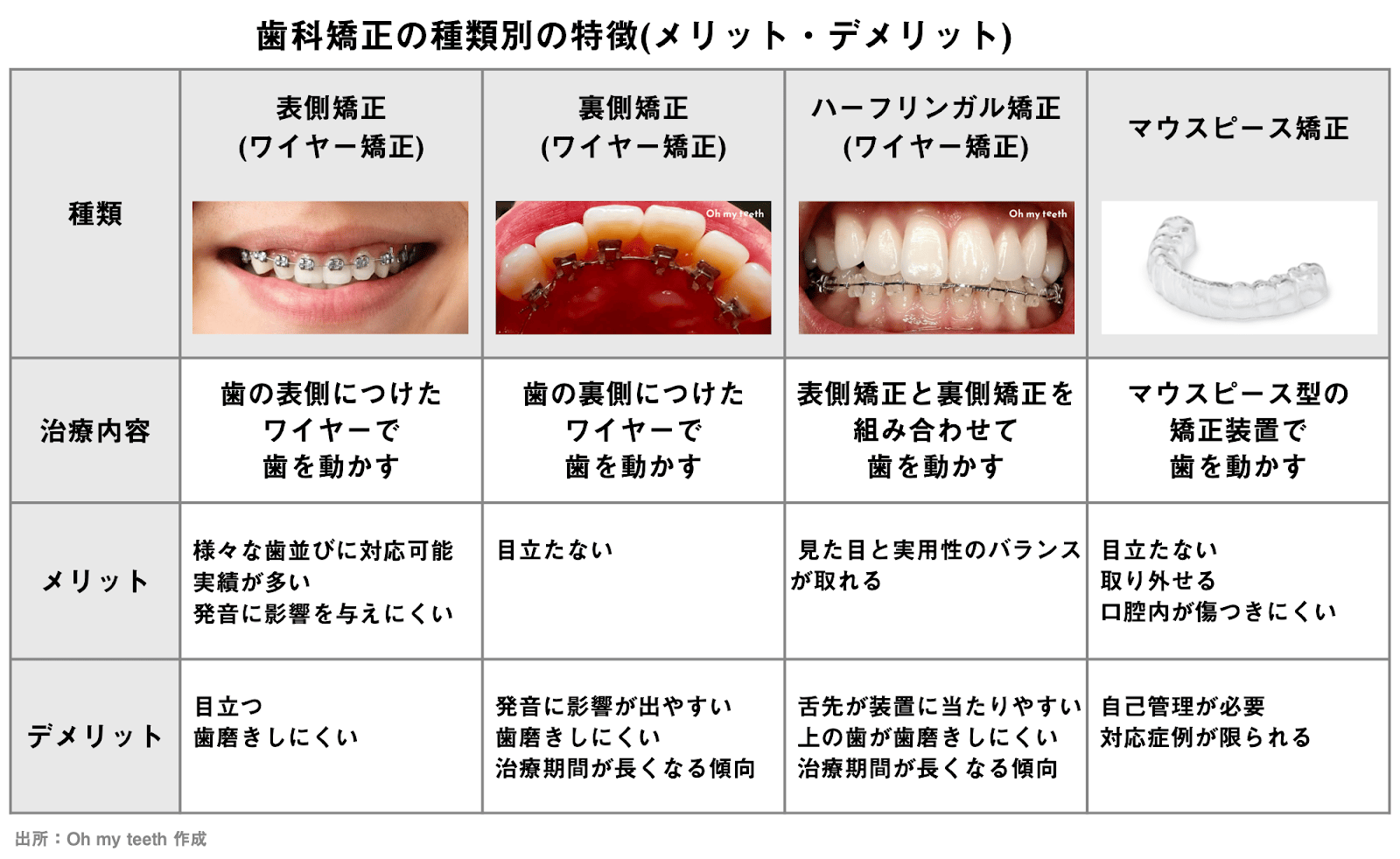 歯科矯正の種類別の特徴(メリット・デメリット)