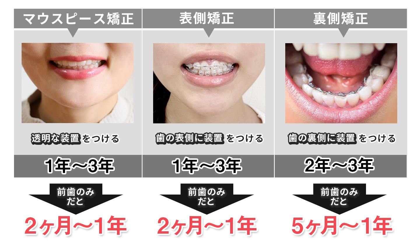 マウスピース矯正の期間の目安