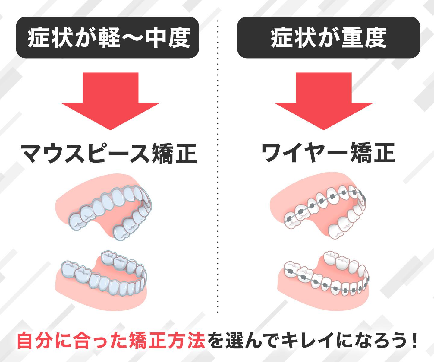 【ワイヤー矯正？マウスピース矯正？】自分に合った種類の選び方