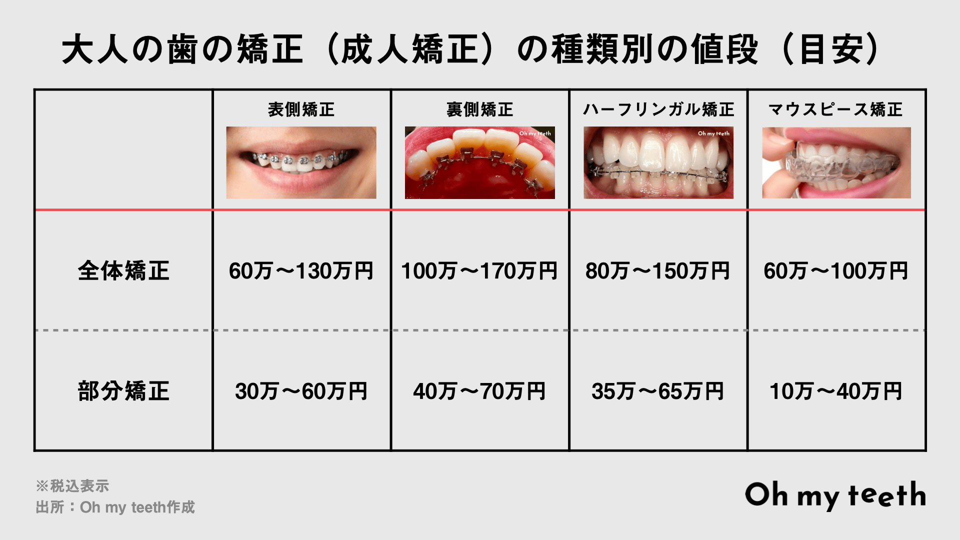大人の歯の矯正の種類別の値段