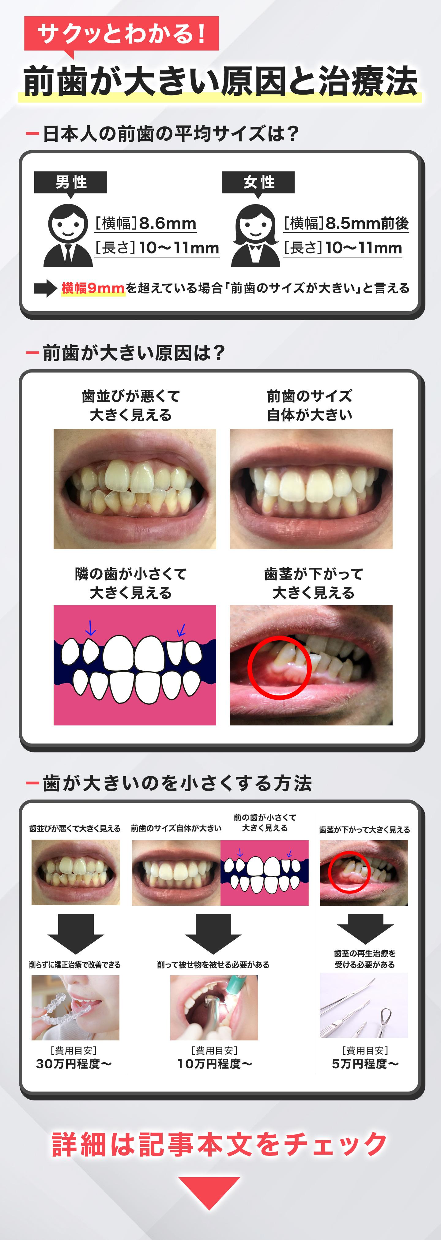 サクッとわかる！前歯が大きい原因と治療法