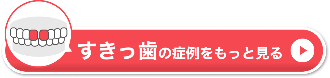 すきっ歯の症例をもっと見る