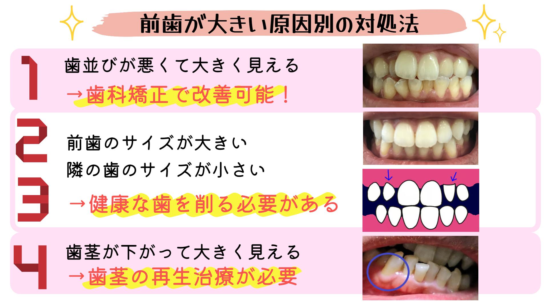 画像素材②