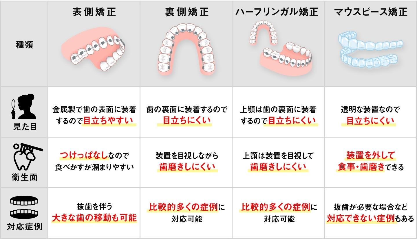 歯列矯正の種類別の特徴の違い