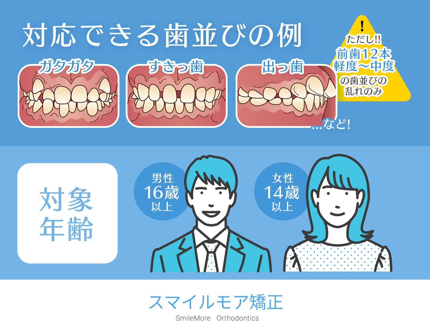 スマイルモア矯正の適応症例と対象年齢