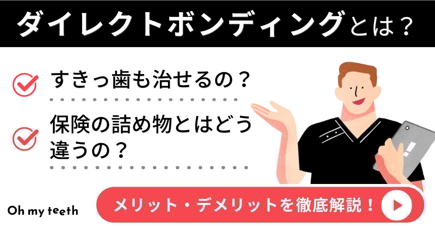 ダイレクトボンディング　アイキャッチ